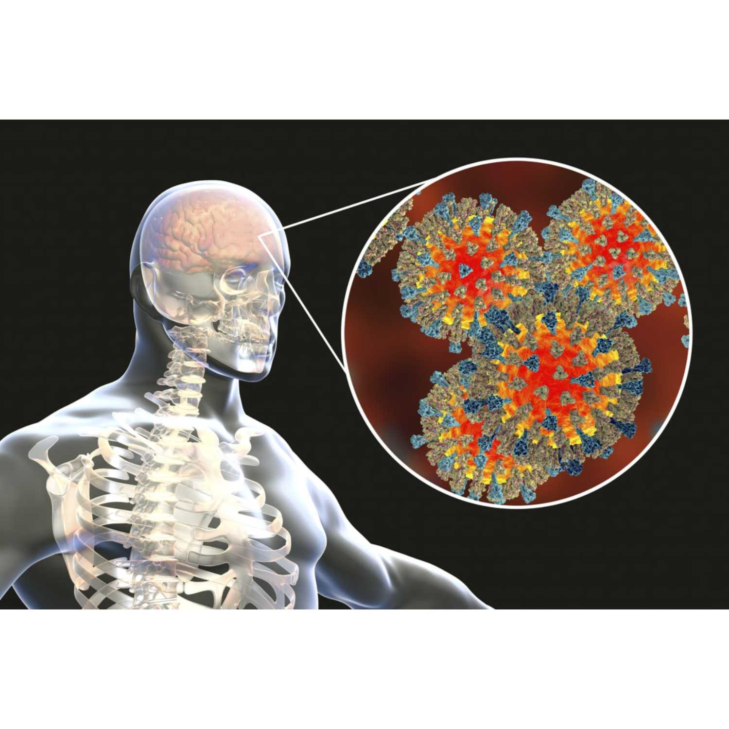 Low serotonin and gut inflammation may cause brain fog in long COVID episode artwork