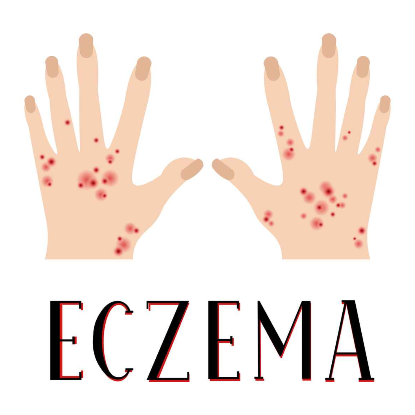 Symptoms and Causes Of Eczema: Your Complete Guide episode artwork