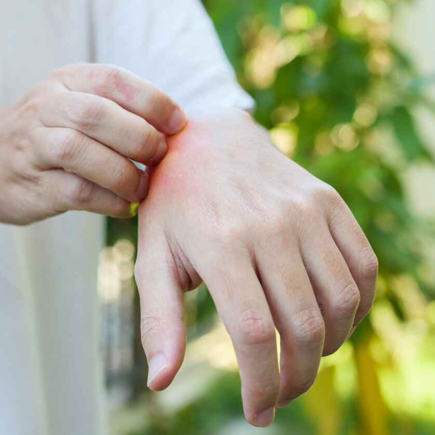 How Eczema Research On Skin Bacteria May Lead To A Treatment For Itching episode artwork