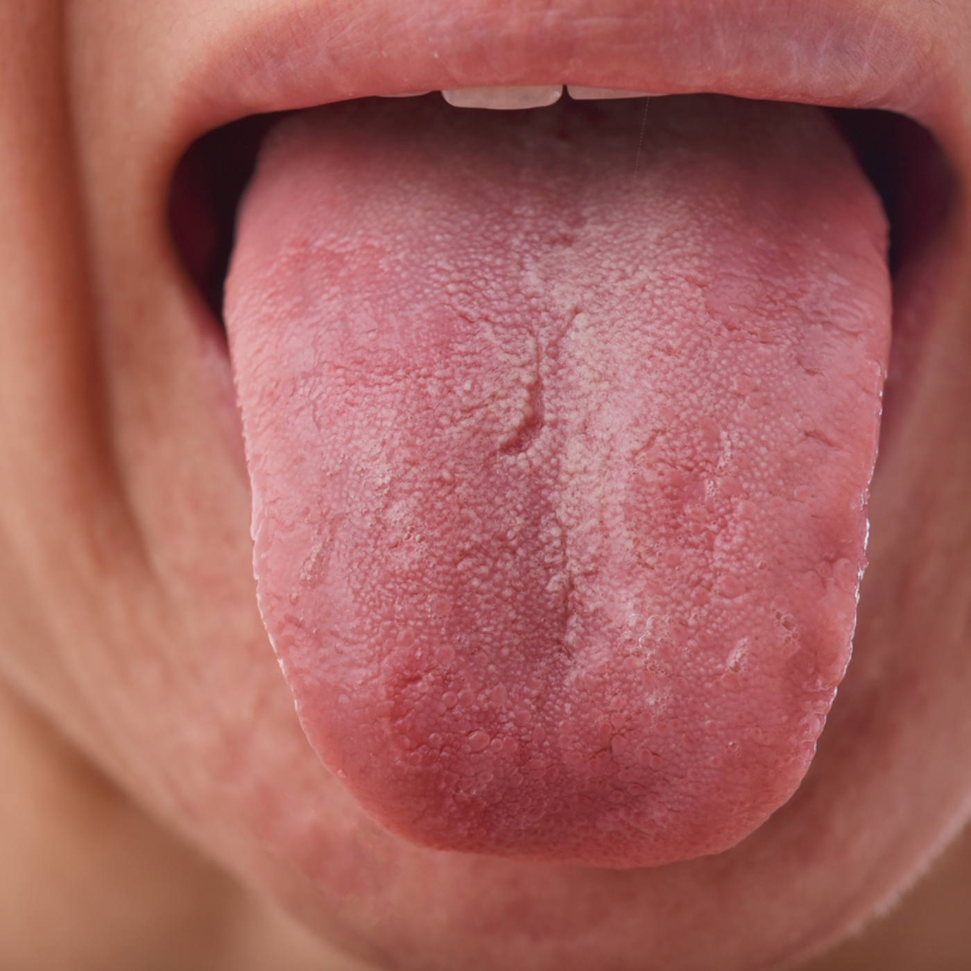 10 Oral Thrush Home Remedies episode artwork