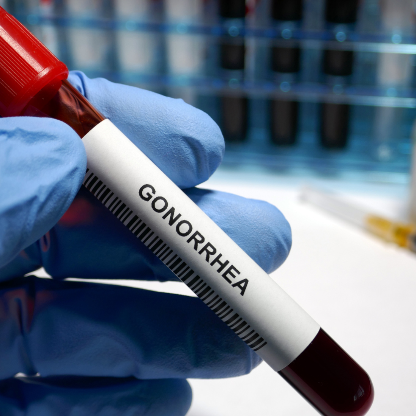 Why Is Gonorrhea Called The Clap? episode artwork