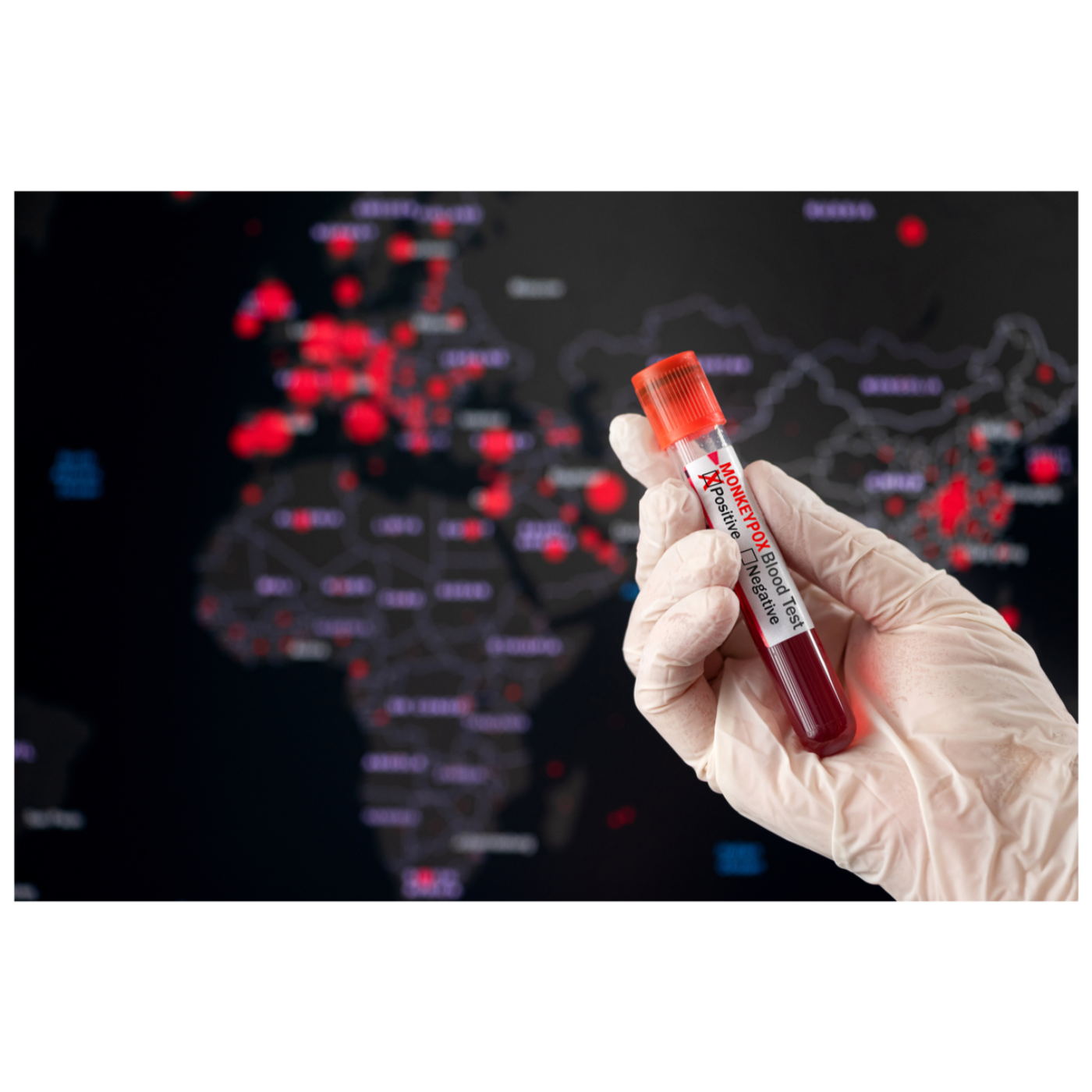 Mpox Outbreak in the EU Explained: Key Facts, Insights, and Preventive Measures episode artwork