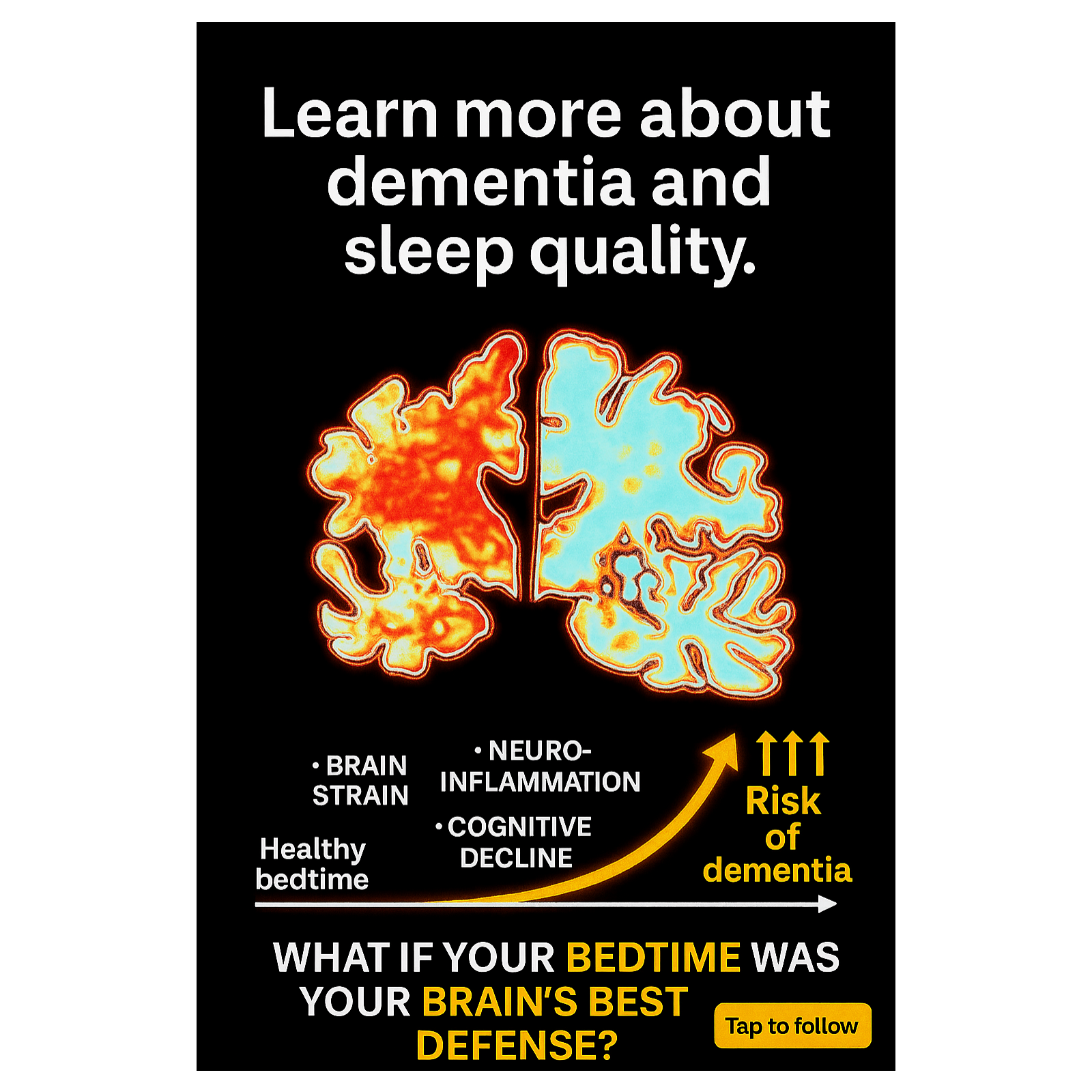 Sleep, the Silent Shield: How Rest Protects Your Brain from Dementia