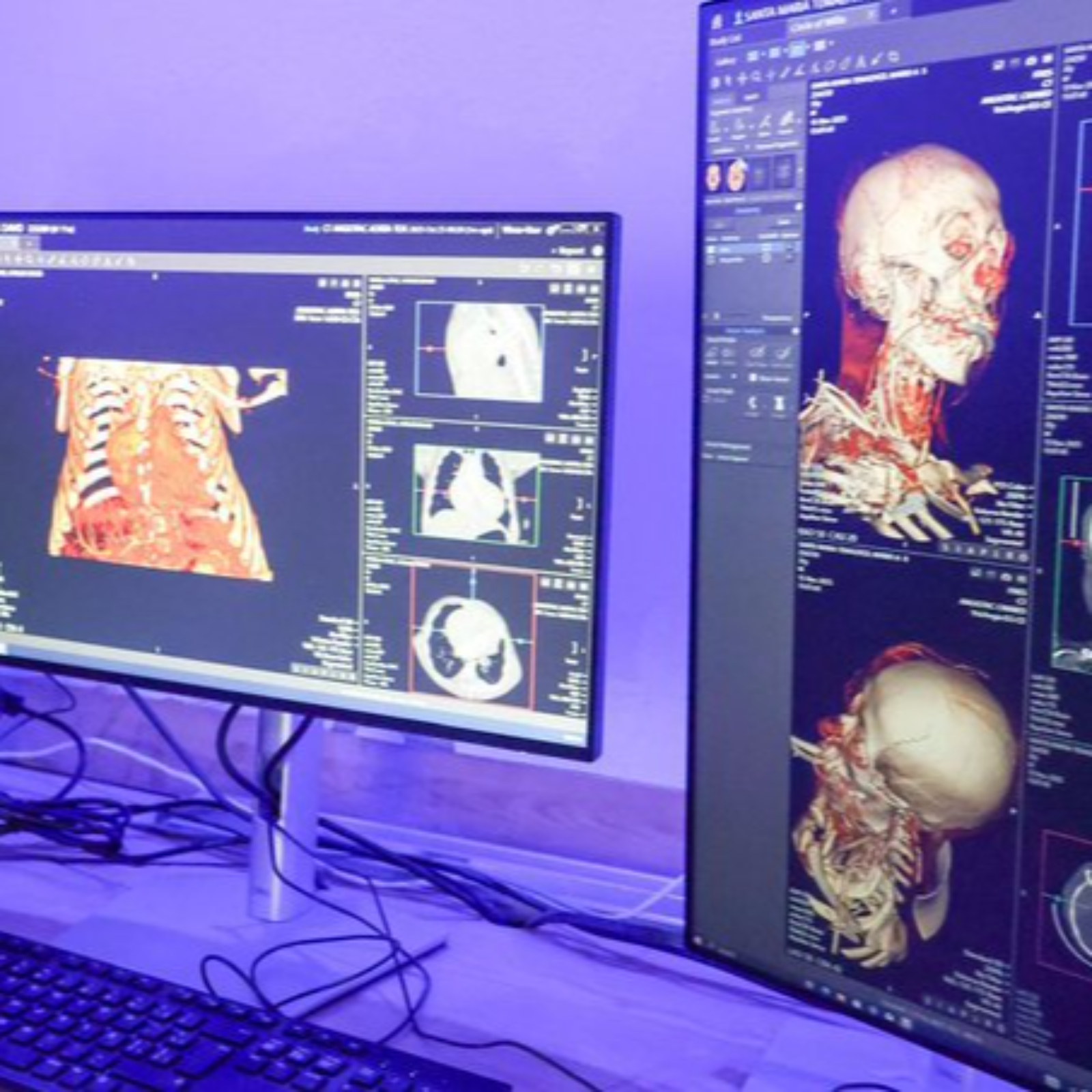 MODERNIZA EL GOBIERNO DE TLAXCALA EL ITAES CON 125 MDP, PERO PERSISTEN DUDAS SOBRE SU ALCANCE REAL