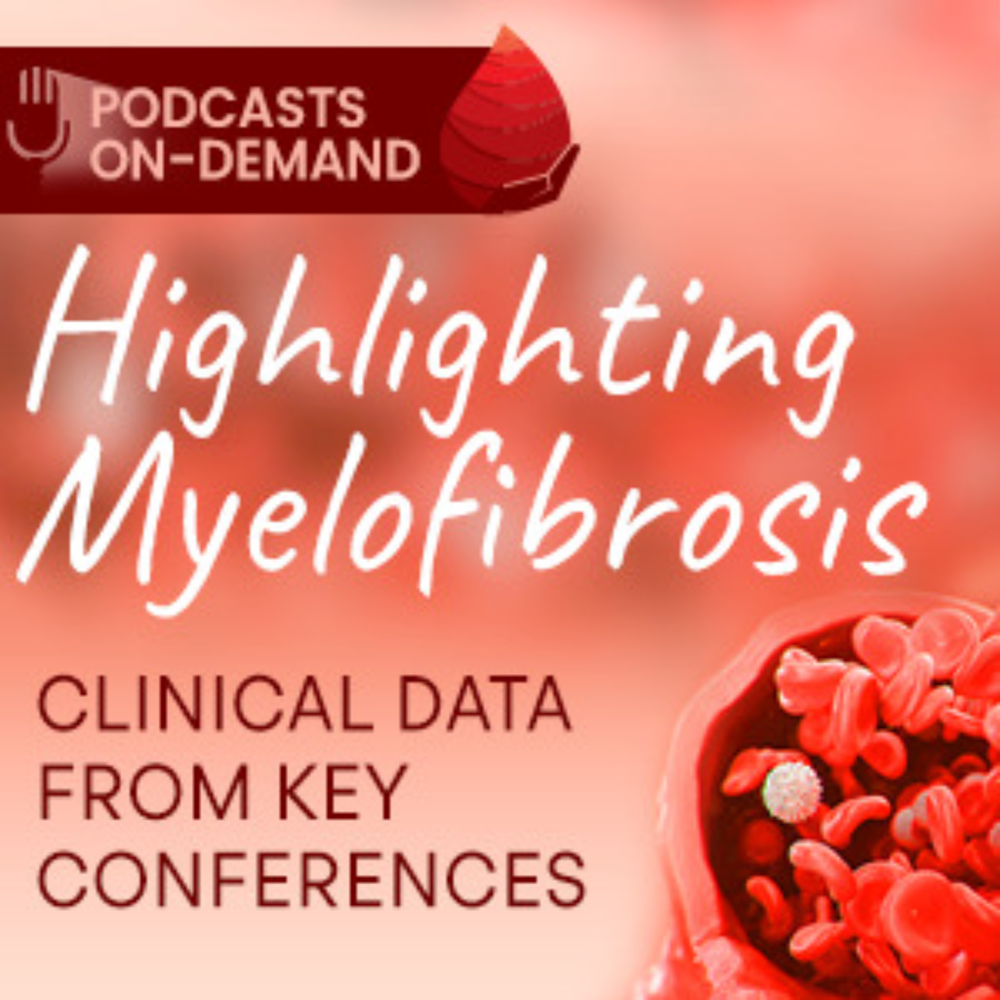 Episode 14 - Conference Briefs: Highlighting Myelofibrosis Clinical Data from Key Conferences - Part 2: Current and emerging JAK inhibitors in MF episode artwork