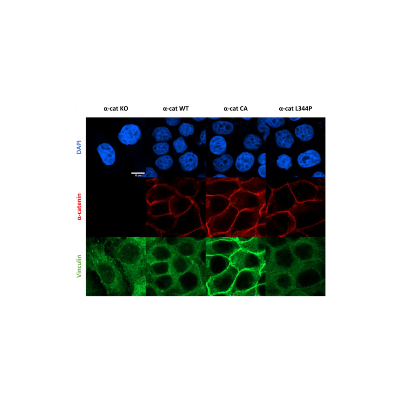S1Ep18 Interview with Daniel Conway about the importance of epithelial cells