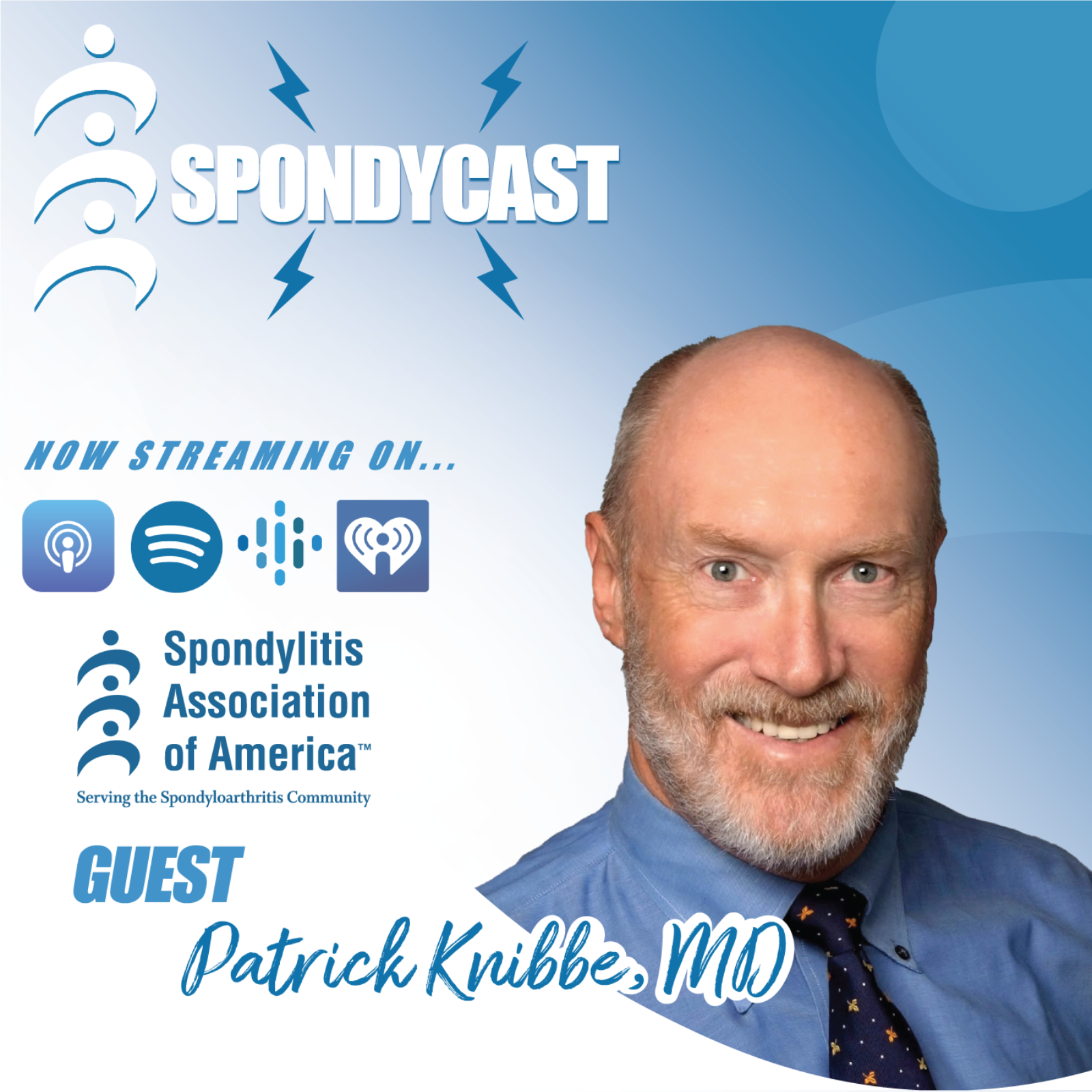 Why Spondyloarthritis Is Still Missed: Lessons from a Rheumatologist Living with Spondyloarthritis