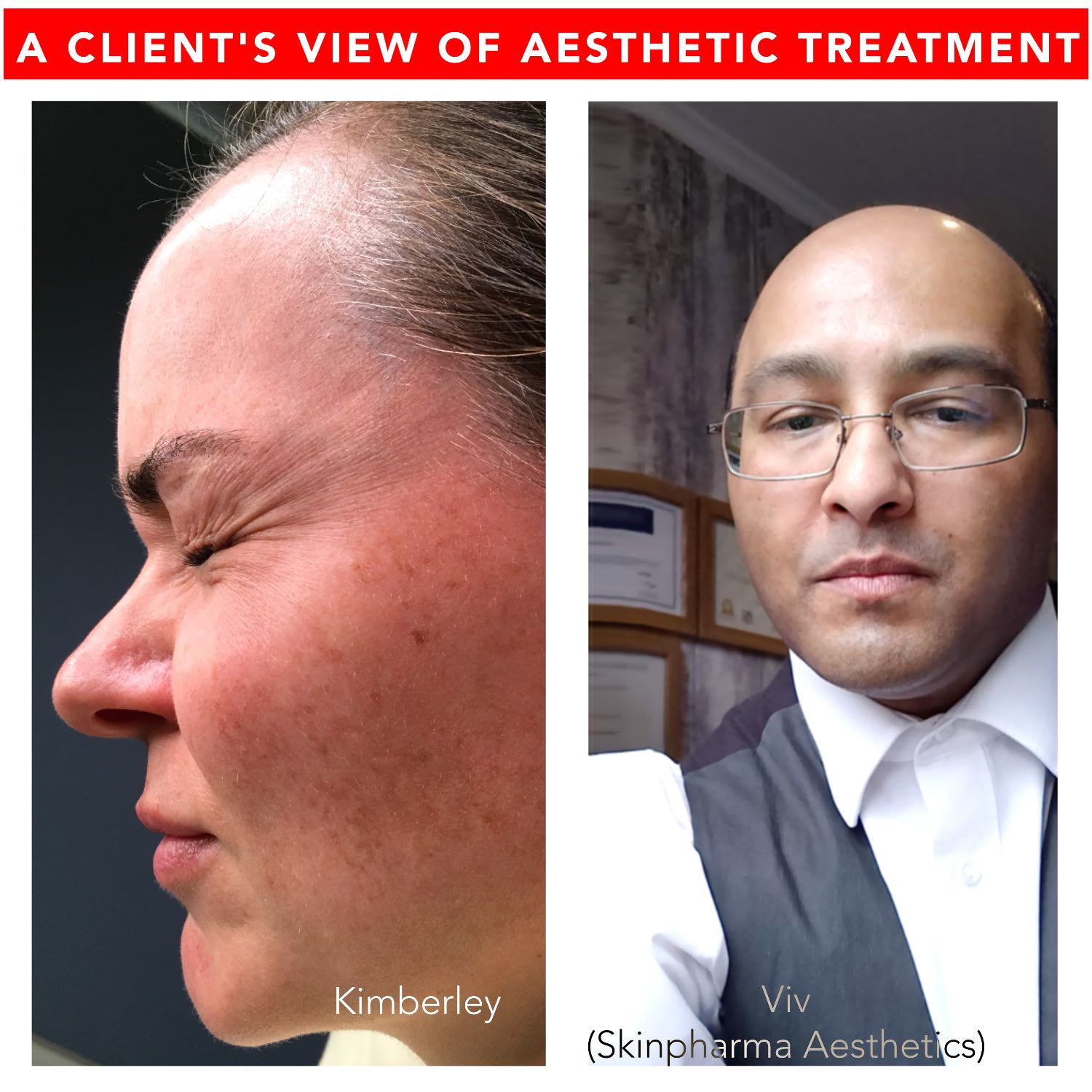 Skinpharma Aesthetics: Viv talks about non-surgical aesthetic treatments