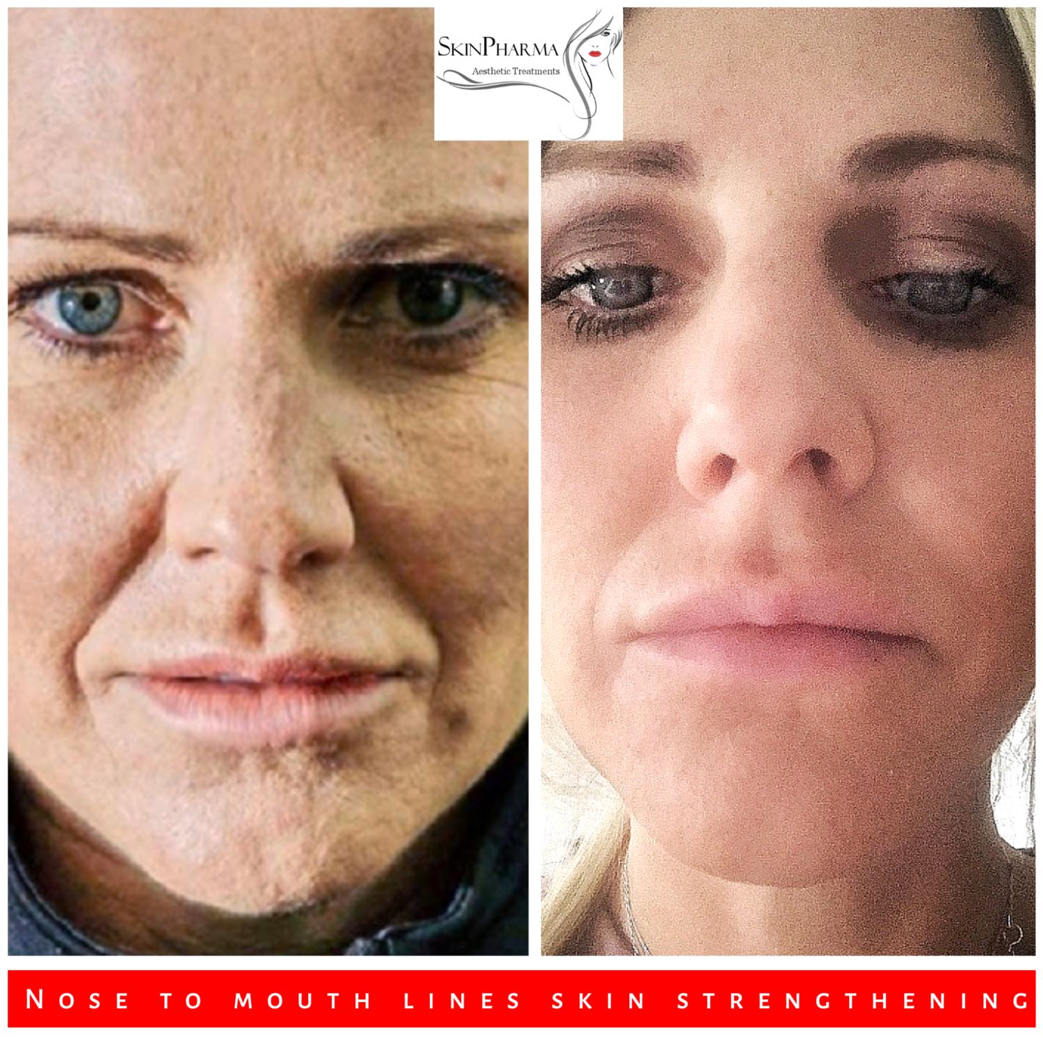 Skinpharma Aesthetics: Viv talks about non-surgical aesthetic treatments