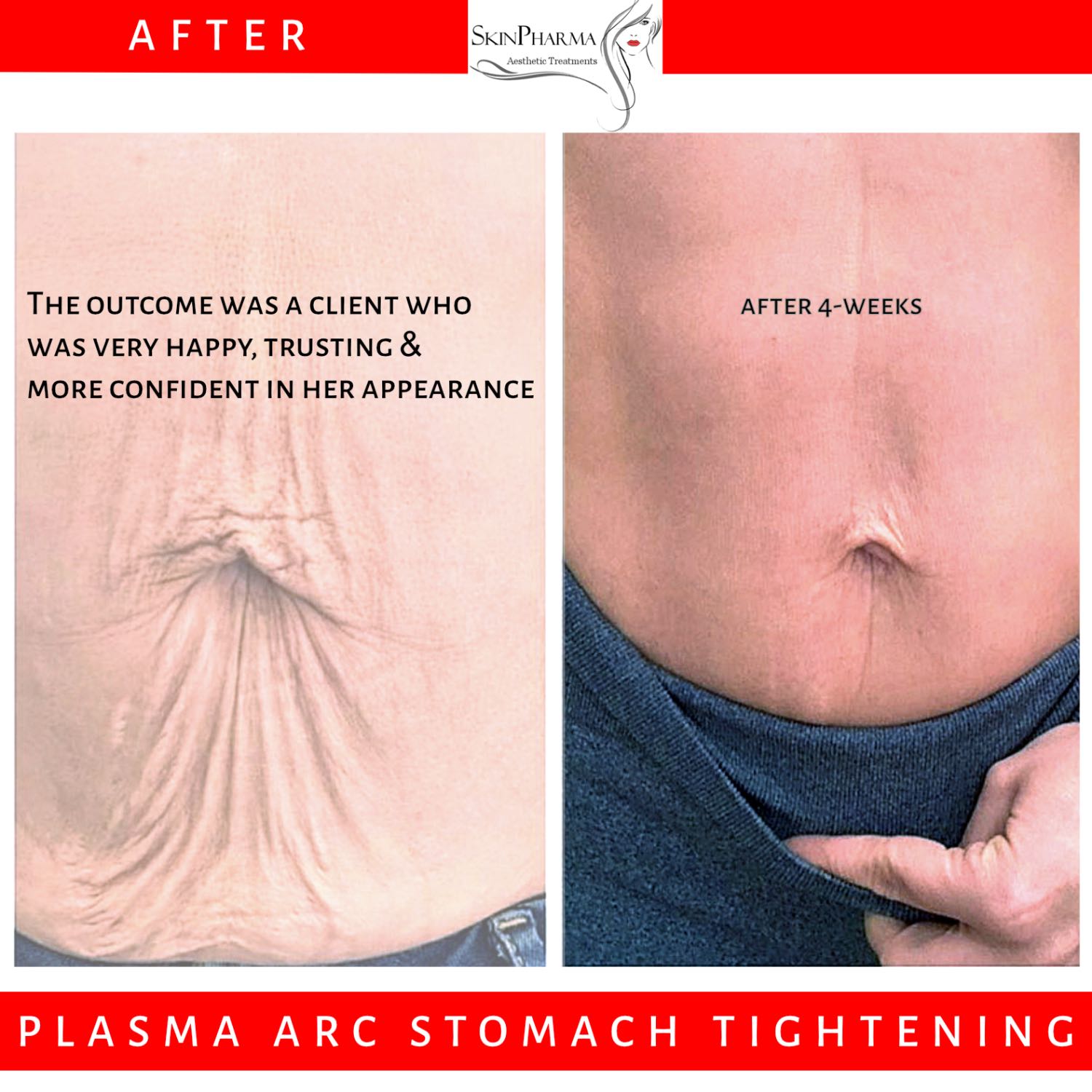 Skinpharma Aesthetics: Viv talks about non-surgical aesthetic treatments