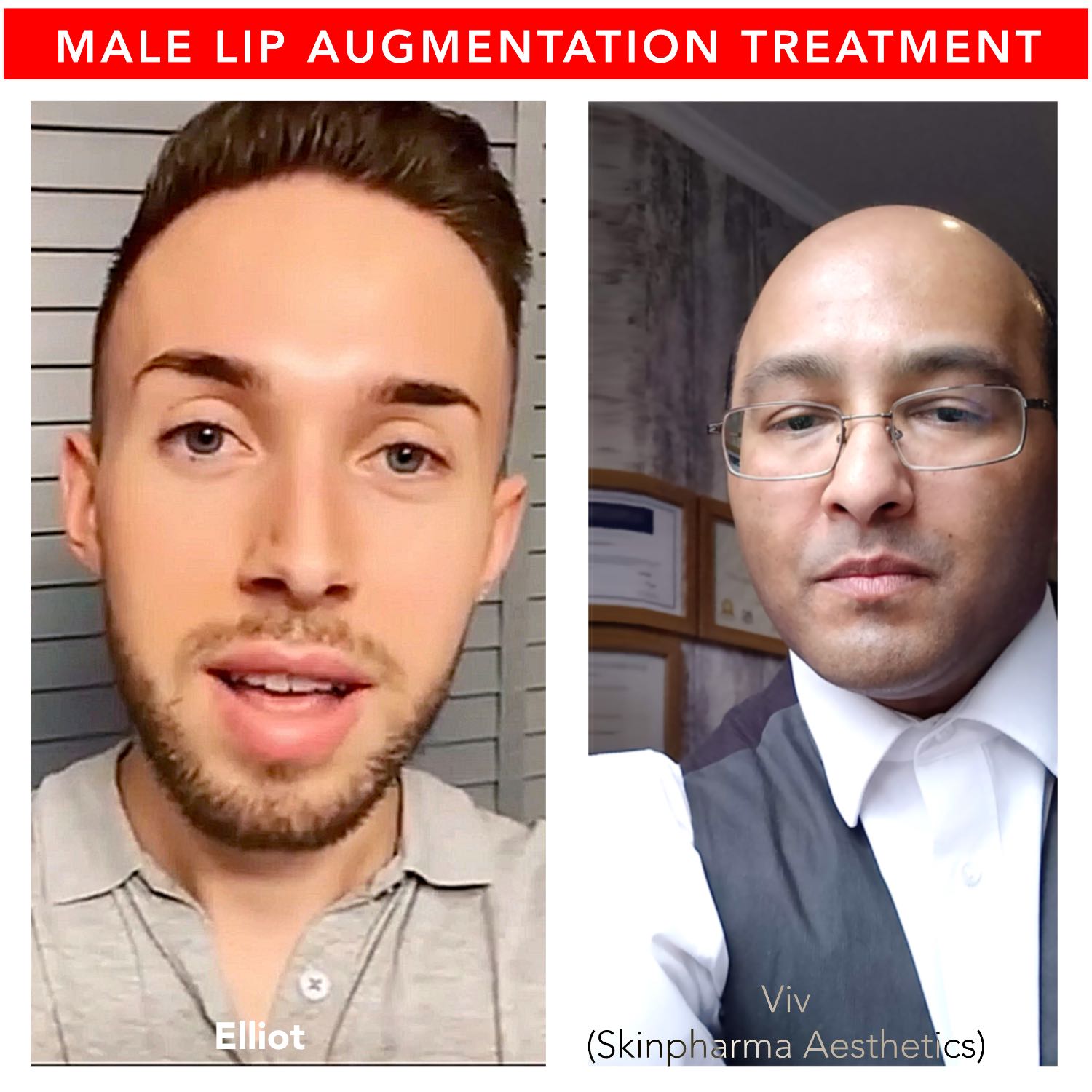 Skinpharma Aesthetics: Viv talks about non-surgical aesthetic treatments