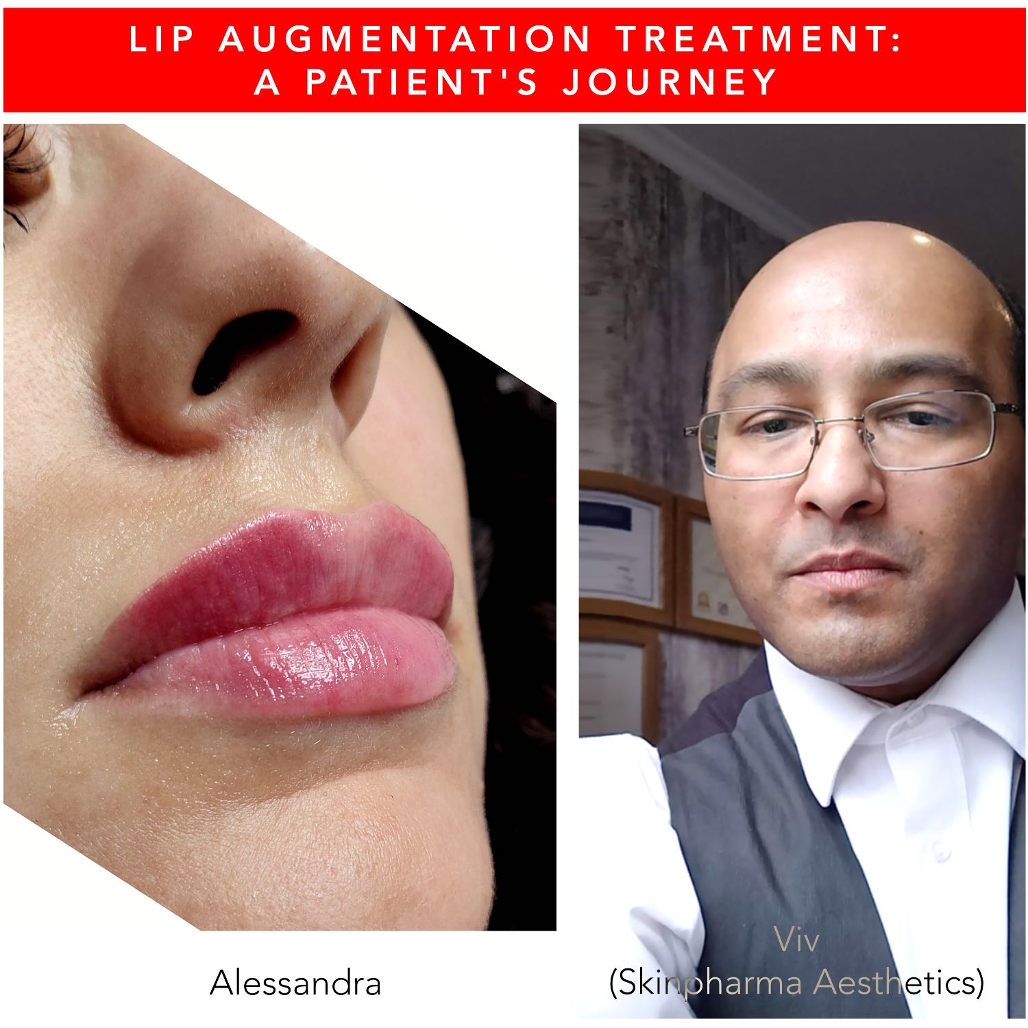Skinpharma Aesthetics: Viv talks about non-surgical aesthetic treatments