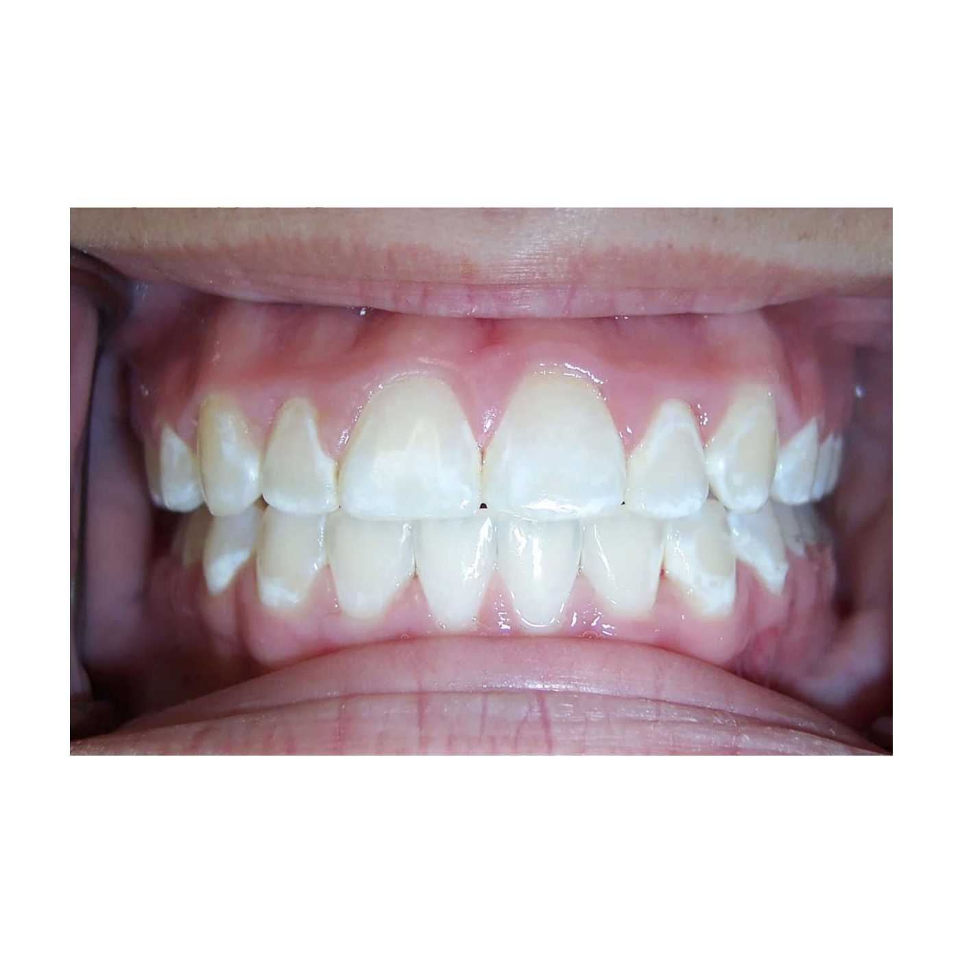 Smile Stories: Transforming Lives Through Dentistry