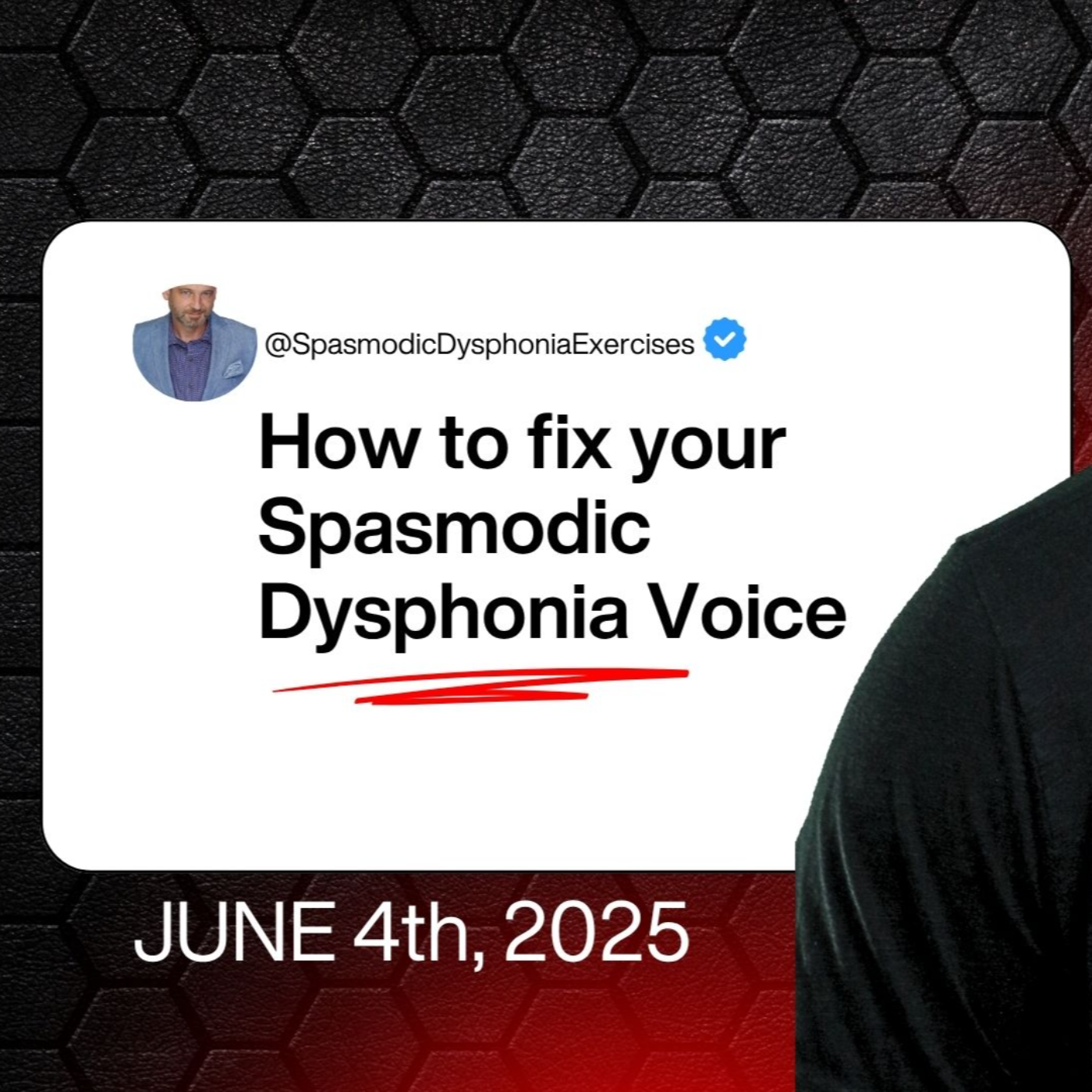 Spasmodic Dysphonia & Muscle Tension Dysphonia Exercises