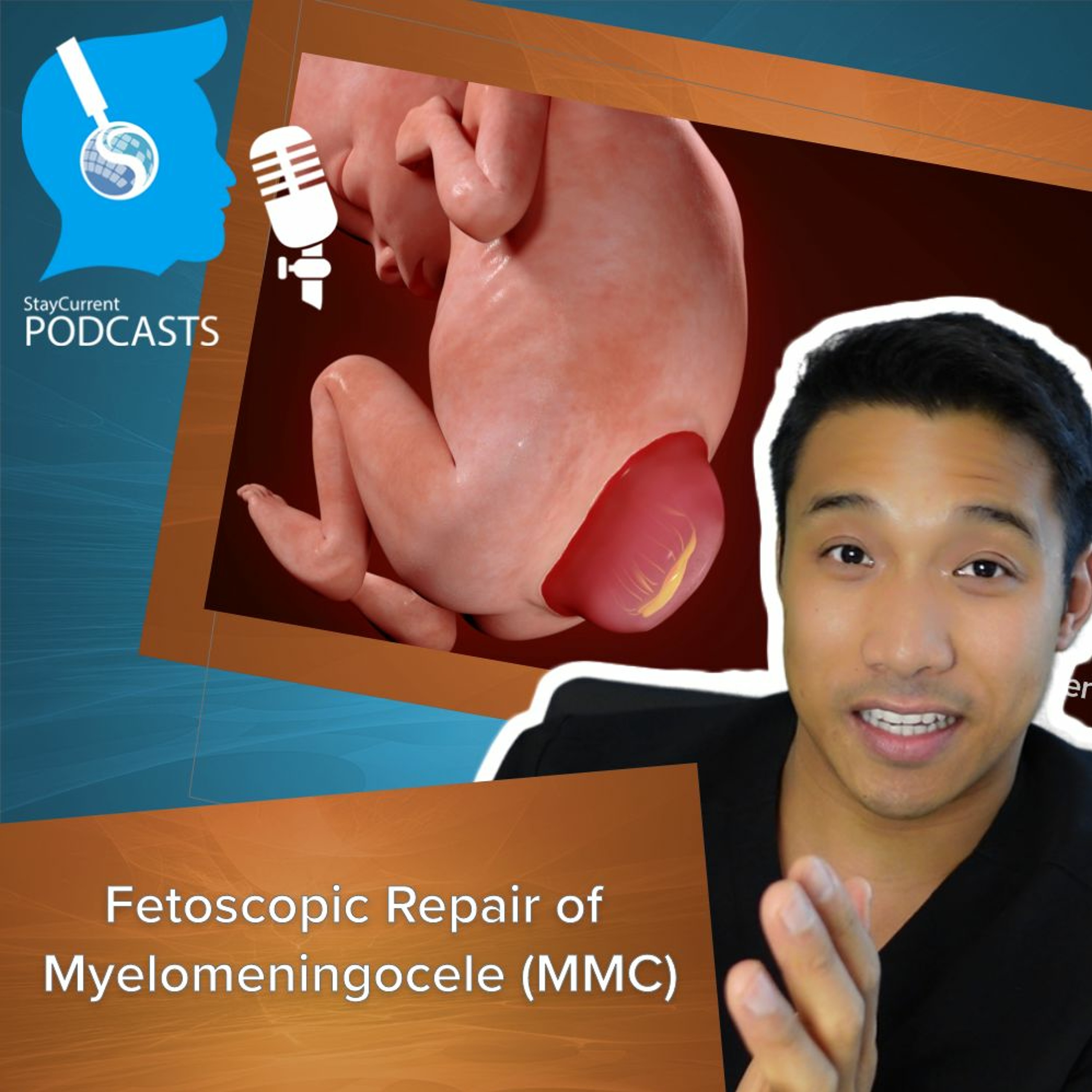 Stay Current in Pediatric Surgery