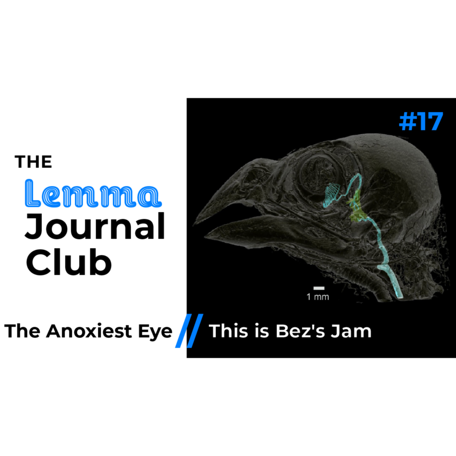The Lemma Journal Club