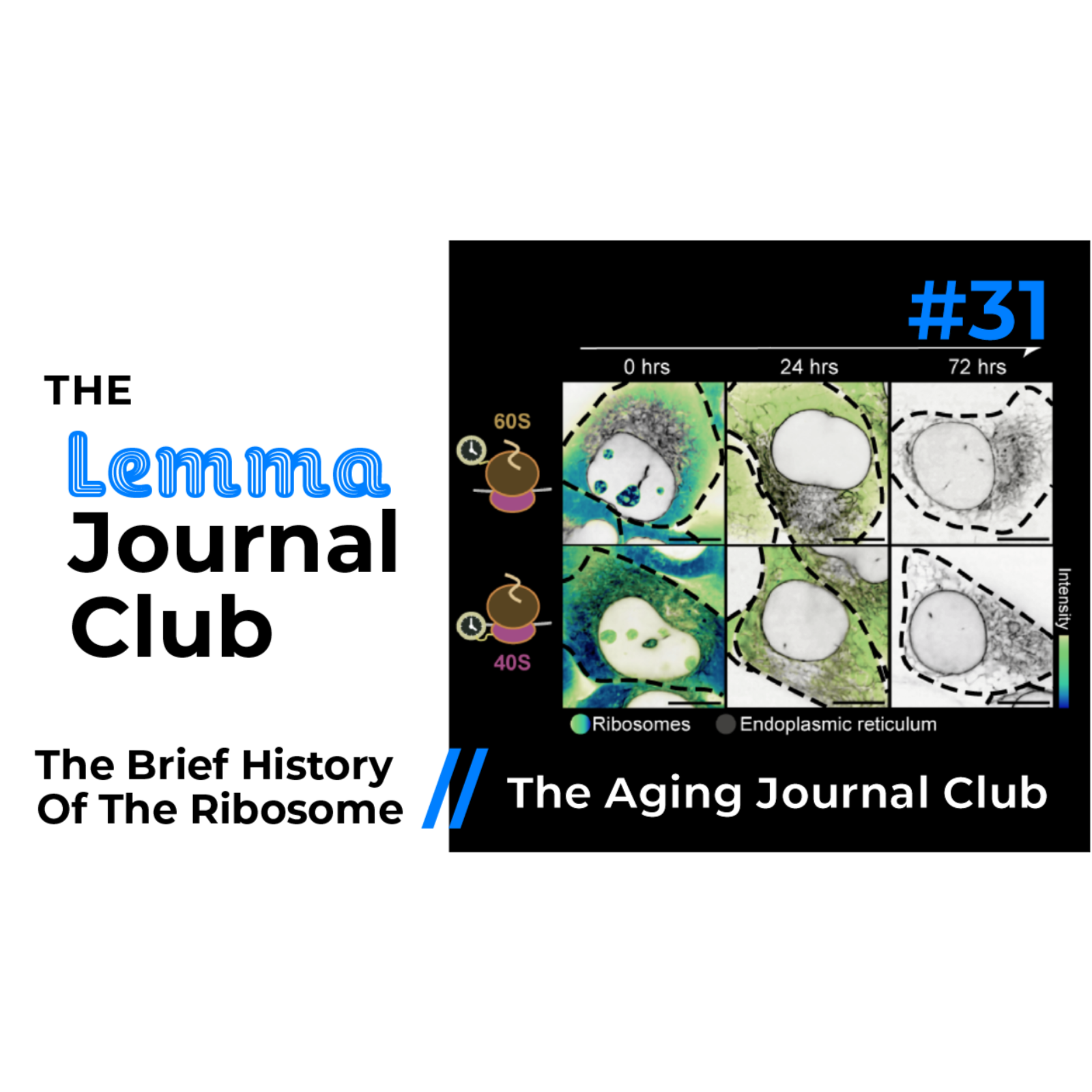 The Brief History Of The Ribosome // The Aging Journal Club [31]