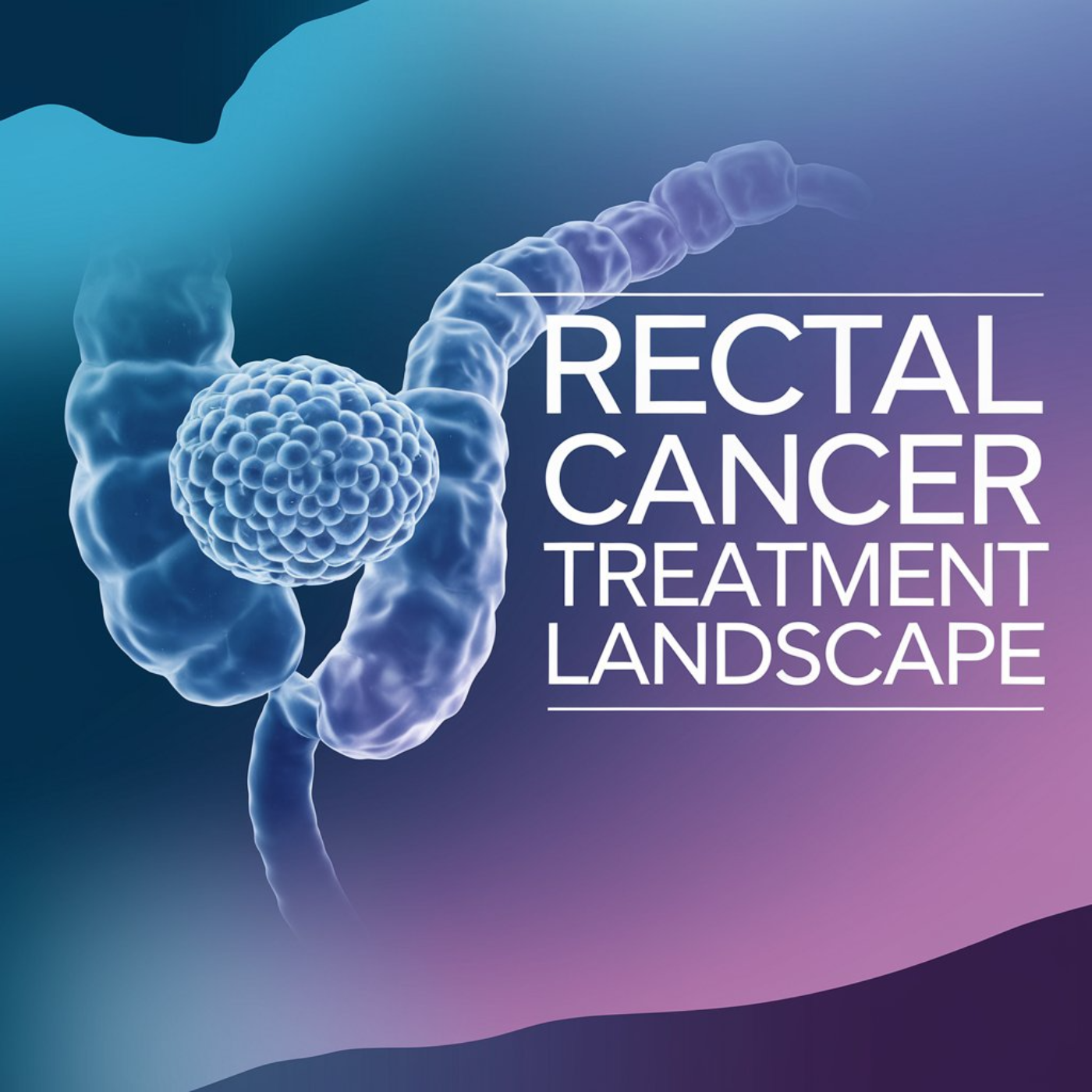The Changing Landscape of Rectal Cancer Treatment episode artwork