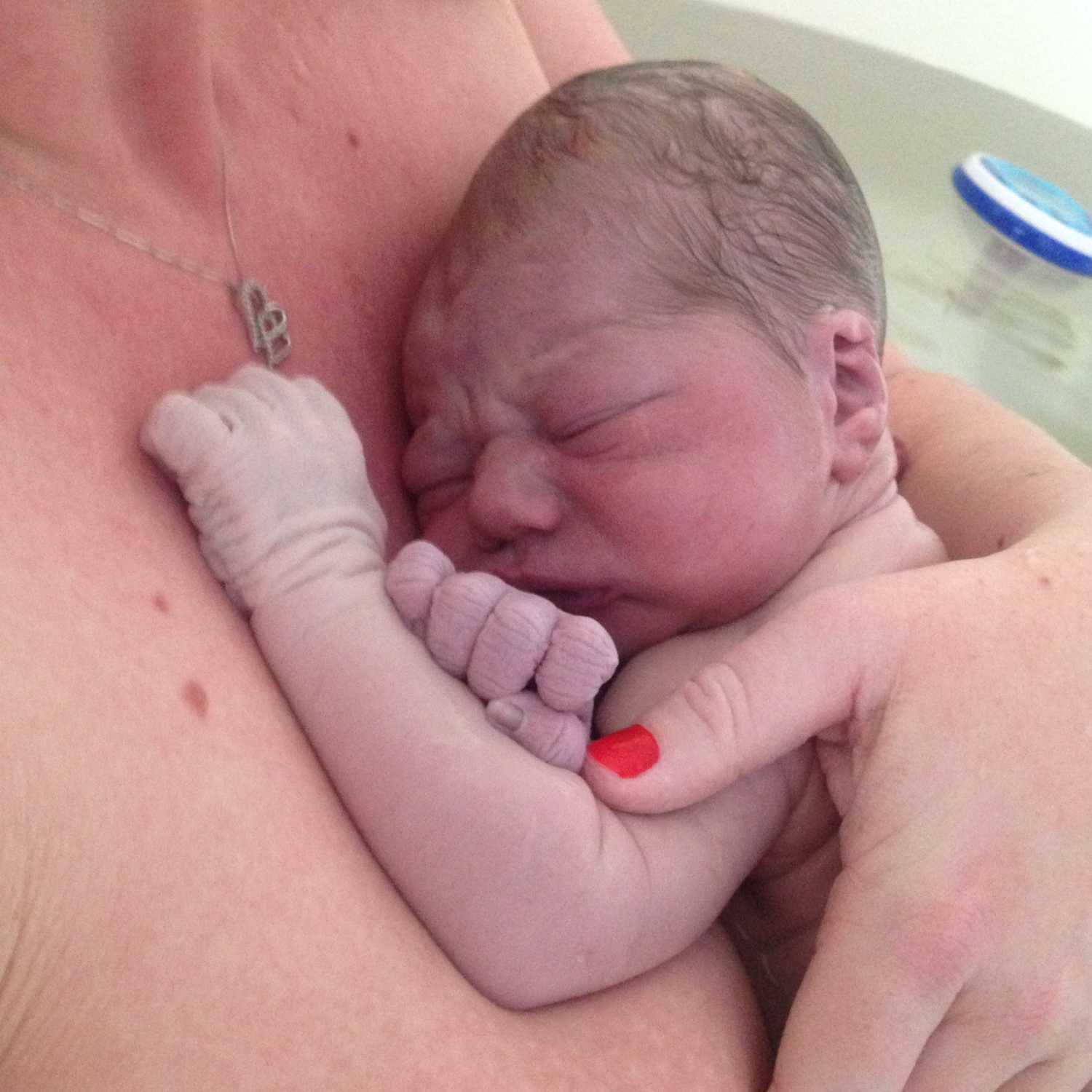 Ep1 What is Birth Trauma?
