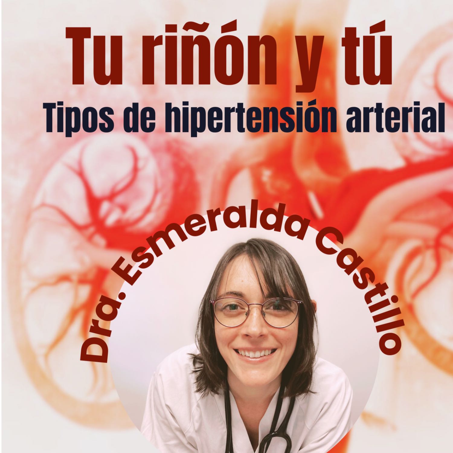 ¿Qué tipo de hipertensión tienes?