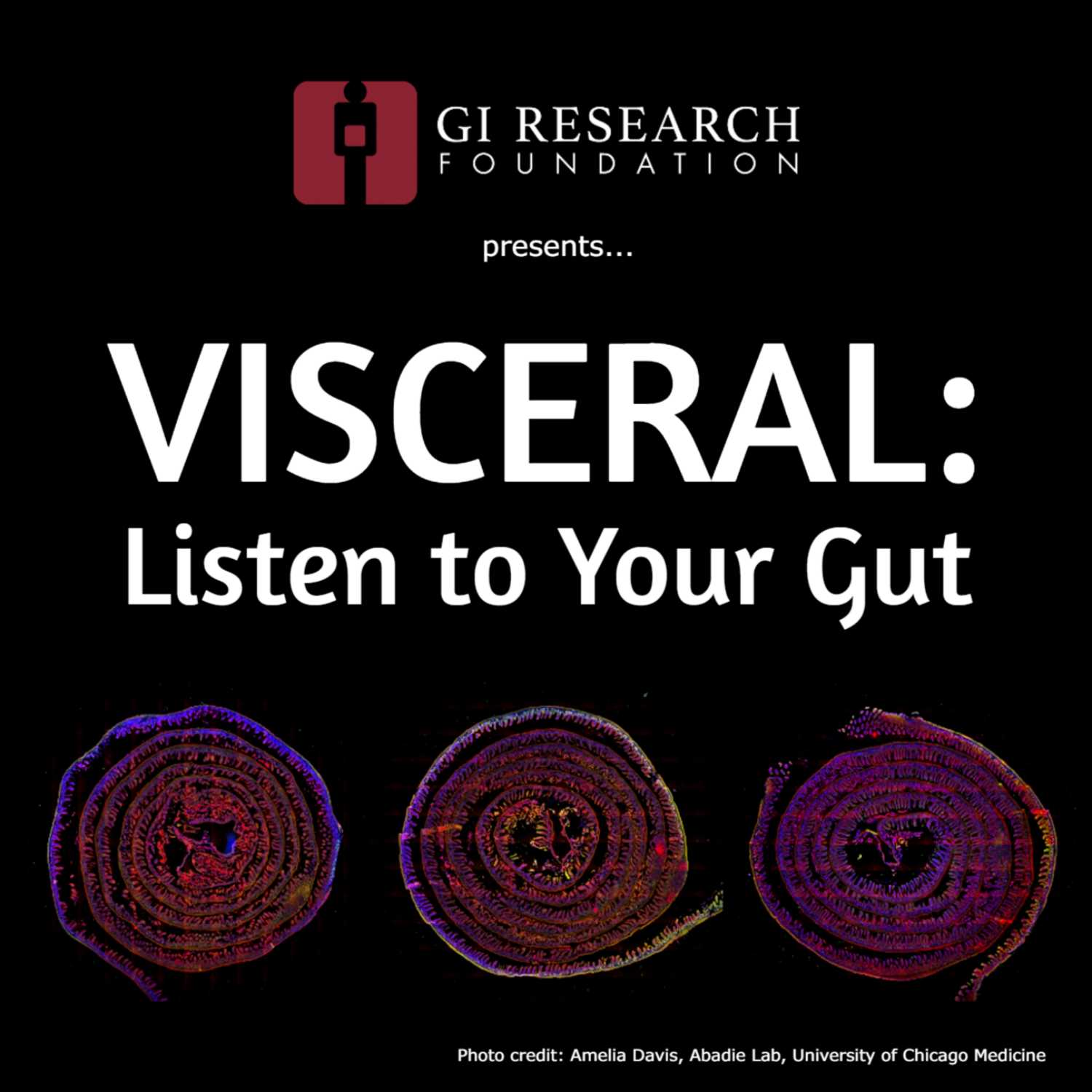 The Role of the Gut Microbiome in Your Health