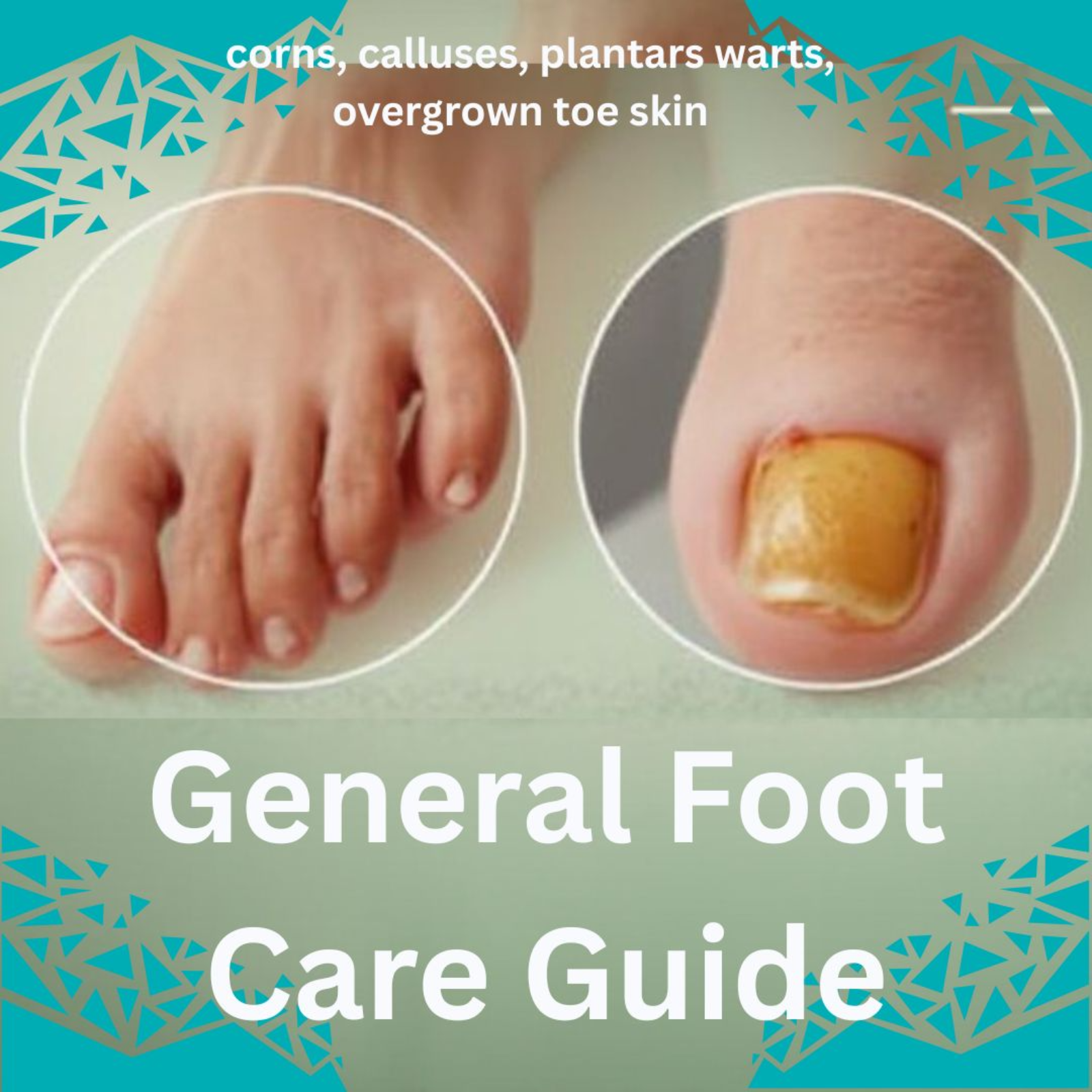 Foot Care Issues Guide