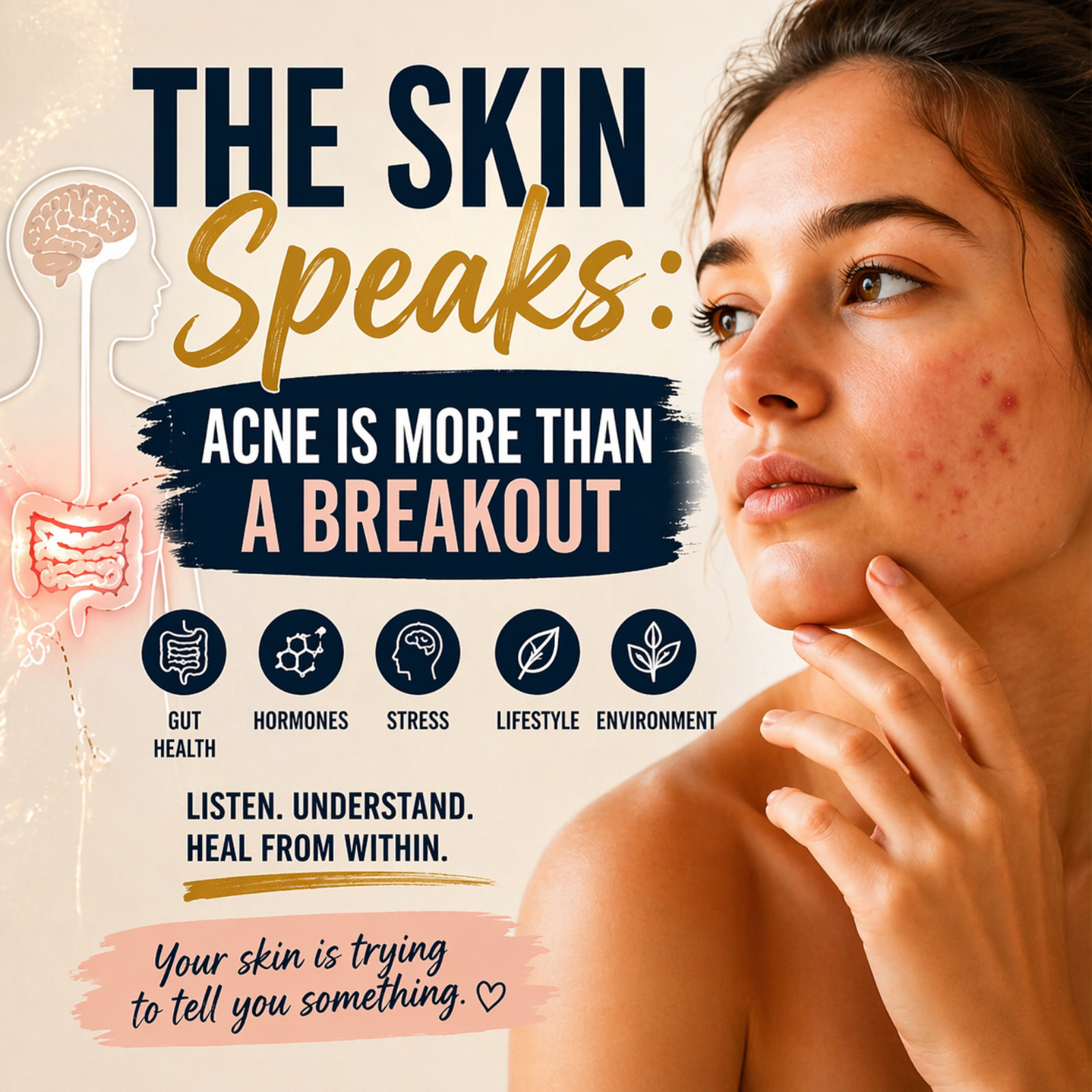 The Skin Speaks: Acne is more than a breakout